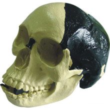 Medical Anatomic Model Bill Toledo Human Skull